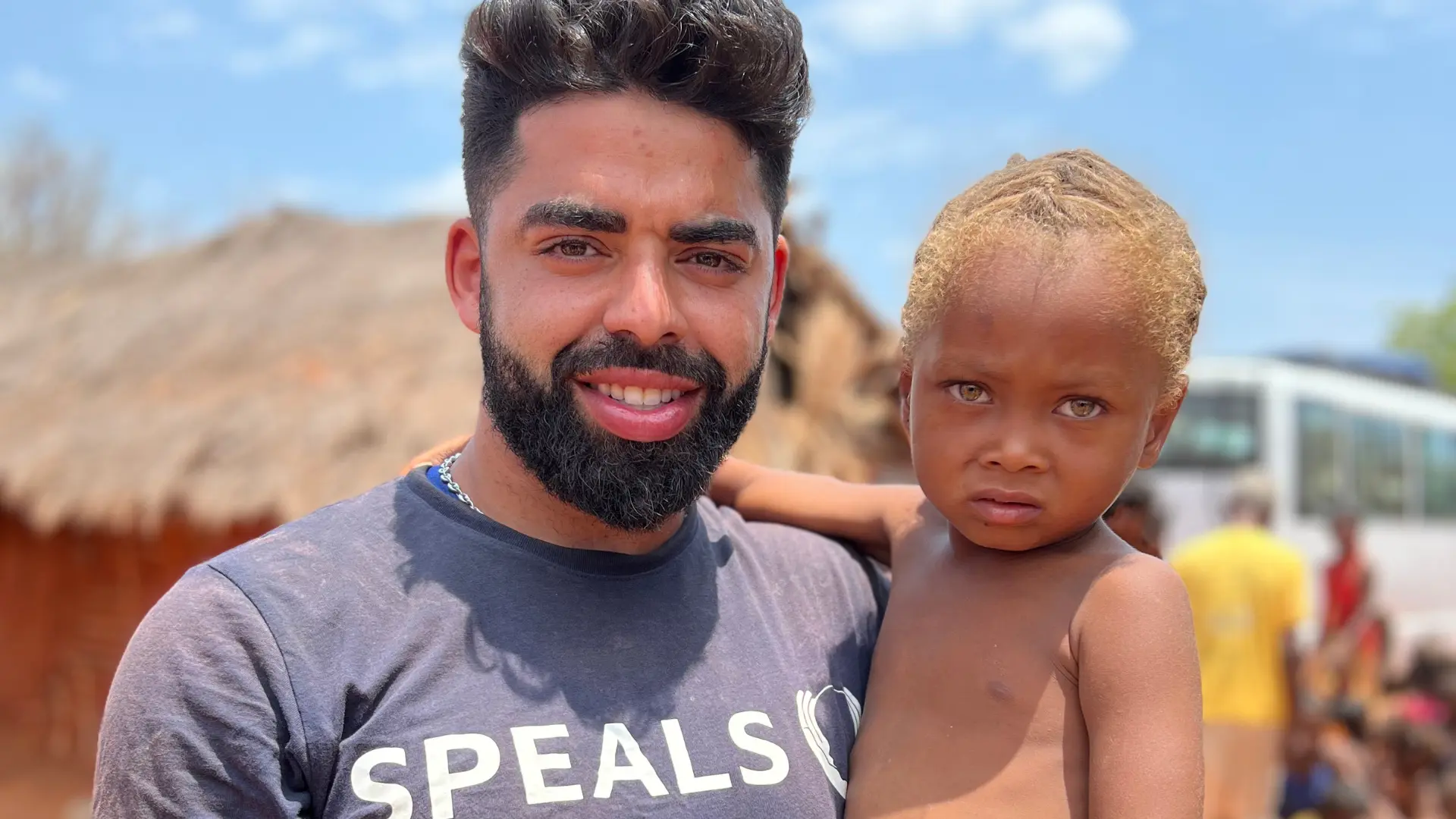 Un bénévole barbu de Speals souriant tient dans ses bras un enfant africain aux cheveux blonds